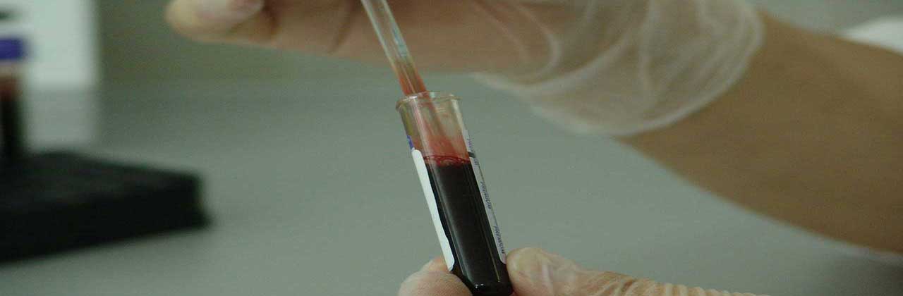 Cancer Research